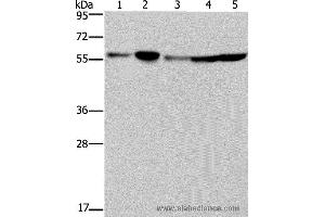 Western blot analysis of Hela, 293T, A549, HT-29 and K562 cell, using NUP50 Polyclonal Antibody at dilution of 1:200 (NUP50 anticorps)