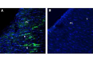 Expression of NMNAT2 in rat fornixImmunohistochemical staining of perfusion-fixed frozen rat brain sections with Anti-NMNAT2 Antibody (ABIN7581919), (1:300), followed by goat anti-rabbit-AlexaFluor-488. (NMNAT2 anticorps  (Intracellular))