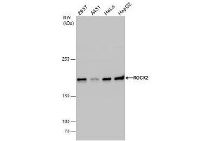 WB Image ROCK2 antibody detects ROCK2 protein by western blot analysis. (ROCK2 anticorps)