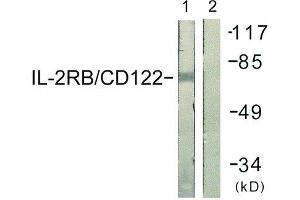 Western Blotting (WB) image for anti-Interleukin 2 Receptor, beta (IL2RB) (Tyr364) antibody (ABIN1848052) (IL2 Receptor beta anticorps  (Tyr364))
