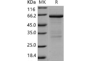Western Blotting (WB) image for Matrix Metallopeptidase 8 (Neutrophil Collagenase) (MMP8) protein (ABIN7196954) (MMP8 Protéine)