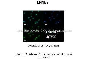 Researcher: Dr. (Lamin B2 anticorps  (N-Term))