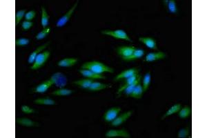 Immunofluorescent analysis of Hela cells using ABIN7156468 at dilution of 1:100 and Alexa Fluor 488-congugated AffiniPure Goat Anti-Rabbit IgG(H+L)