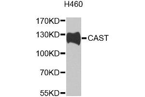 Western blot analysis of extracts of H460 cells, using CAST antibody (ABIN2650901) at 1:1000 dilution. (Calpastatin anticorps)