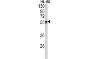 Western blot analysis of NR1H2 Antibody (N-term) in HL-60 cell line lysates (35ug/lane). (NR1H2 anticorps  (N-Term))