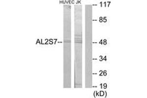 Western blot analysis of extracts from Jurkat/HuvEc cells, using AL2S7 Antibody. (Cyclin-Dependent Kinase 15 (ALS2CR7) (AA 261-310) anticorps)