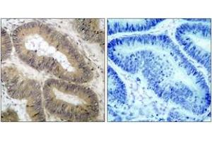 Immunohistochemistry (IHC) image for anti-conserved Helix-Loop-Helix Ubiquitous Kinase (CHUK) (pThr23) antibody (ABIN2888444) (IKK alpha anticorps  (pThr23))