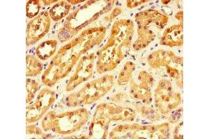 Immunohistochemistry of paraffin-embedded human kidney tissue using ABIN7142008 at dilution of 1:100 (PDK4 anticorps  (AA 143-333))