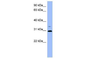 WB Suggested Anti-PSPH Antibody Titration: 0. (PSPH anticorps  (Middle Region))