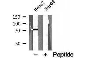 Western blot analysis of extracts of HepG2 cells, using ERp72 antibody. (PDIA4 anticorps  (Internal Region))