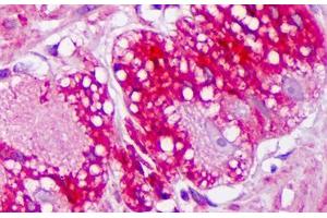 Anti-TRPV3 antibody IHC staining of human colon, ganglion. (TRPV3 anticorps  (AA 458-474))