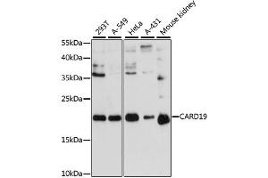 Western blot analysis of extracts of various cell lines, using CARD19 antibody. (C9orf89 anticorps)