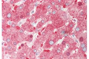 Rabbit Anti-PDE1A antibody Catalog Number: ARP53625 Formalin Fixed Paraffin Embedded Tissue: Human Liver Primary antibody Concentration: 1:100 Secondary Antibody: Donkey anti-Rabbit-Cy3 Secondary Antibody Concentration: 1:200 Magnification: 20x Exposure Time: 0. (PDE1A anticorps  (C-Term))