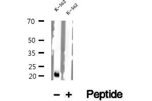 Western blot analysis of extracts of K-562 cells, using NDUFS7 antibody. (NDUFS7 anticorps  (Internal Region))