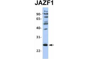 Host:  Rabbit  Target Name:  JAZF1  Sample Type:  MCF7  Antibody Dilution:  1.