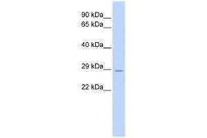 TRIM55 antibody used at 1 ug/ml to detect target protein. (TRIM55 anticorps  (Middle Region))