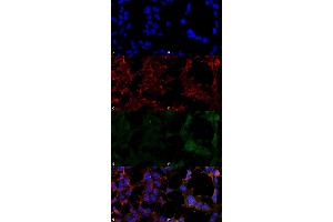 Immunocytochemistry/Immunofluorescence analysis using Mouse Anti-Hexanoyl-Lysine adduct Monoclonal Antibody, Clone 5D9 . (Hexanoyl-Lysine Adduct (HEL) anticorps)