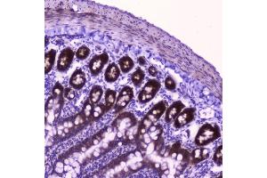 IHC analysis of FLIP using anti-FLIP antibody (ABIN5693075). (FLIP anticorps  (AA 1-376))