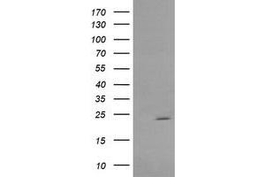 Image no. 5 for anti-RAB30, Member RAS Oncogene Family (RAB30) antibody (ABIN1500558)