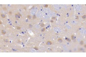 Detection of GKRP in Rat Cerebrum Tissue using Polyclonal Antibody to Glucokinase Regulatory Protein (GKRP)