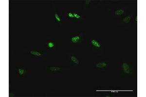 Immunofluorescence of purified MaxPab antibody to TCEB3 on HeLa cell. (TCEB3 anticorps  (AA 1-772))