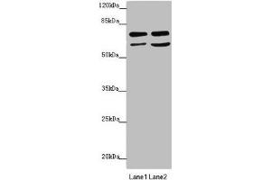 Western blot All lanes: VPS33B antibody at 2. (VPS33B anticorps  (AA 348-617))