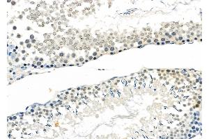 ABIN6263064 and ABIN6272512 at 1/100 staining Rat testis tissue by IHC-P. (MAGEB3 anticorps  (N-Term))