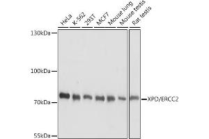Western blot analysis of extracts of various cell lines, using XPD/ERCC2 antibody (ABIN7267056) at 1:1000 dilution. (ERCC2 anticorps  (AA 1-180))