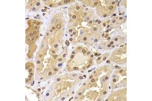 Immunohistochemistry of paraffin-embedded human kidney using PHF21B antibody. (PHF21B anticorps  (AA 322-531))