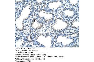 Human Lung (Pirin anticorps  (C-Term))