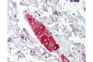 IHC testing of FFPE human colon tissue with FEZ1 antibody at 5ug/ml. (FEZ1 anticorps)