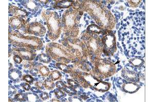 anti-Zinc Finger Protein 75 (ZNF75) (AA 209-258) antibody