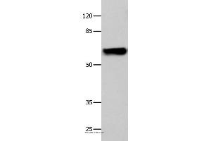 Western blot analysis of 293T cell, using CNGA2 Polyclonal Antibody at dilution of 1:500 (CNGA2 anticorps)