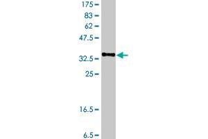 Western Blot detection against Immunogen (37 KDa) . (NPR3 anticorps  (AA 42-140))
