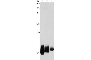 Western Blotting (WB) image for anti-CD59 (CD59) antibody (ABIN5546549) (CD59 anticorps)