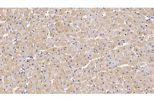 Detection of H-FABP in Human Cardiac Muscle Tissue using Monoclonal Antibody to Heart-type Fatty Acid Binding Protein (H-FABP)