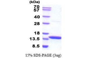 SDS-PAGE (SDS) image for Cystatin B (Stefin B) (CSTB) (AA 1-98) (Active) protein (His tag) (ABIN6387719) (CSTB Protein (AA 1-98) (His tag))