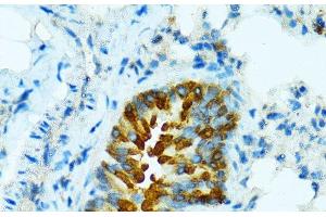 Immunohistochemistry of paraffin-embedded Mouse lung using CYP2B6 Polyclonal Antibody at dilution of 1:100 (40x lens).
