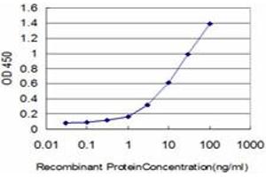 Detection limit for recombinant GST tagged ERN1 is approximately 0. (ERN1 anticorps  (AA 401-500))