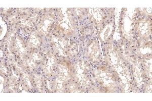 Detection of ASPH in Human Kidney Tissue using Monoclonal Antibody to Aspartate Beta Hydroxylase (ASPH)