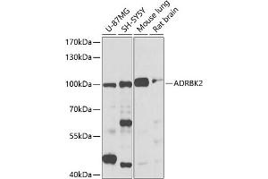 Western blot analysis of extracts of various cell lines, using  antibody (ABIN3022786, ABIN3022787, ABIN3022788 and ABIN6219229) at 1:1000 dilution.