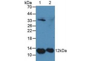 Figure. (s100a4 anticorps  (AA 2-101))