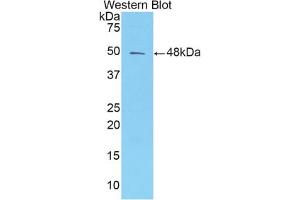 Western blot analysis of the recombinant protein. (AMBP anticorps  (AA 20-202))