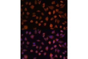 anti-Armadillo Repeat Containing 6 (ARMC6) (AA 1-220) antibody