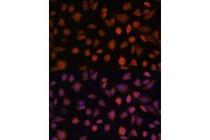 Immunofluorescence analysis of L929 cells using  antibody (ABIN7265674) at dilution of 1:100. (ARMC6 anticorps  (AA 1-220))