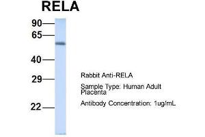 Host: Rabbit  Target Name: RELA  Sample Tissue: Human Adult Placenta  Antibody Dilution: 1. (NF-kB p65 anticorps  (Middle Region))