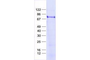 Validation with Western Blot