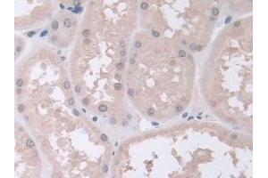 Detection of PSMa5 in Human Kidney Tissue using Polyclonal Antibody to Proteasome Subunit Alpha Type 5 (PSMa5)