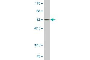 Western Blot detection against Immunogen (61.