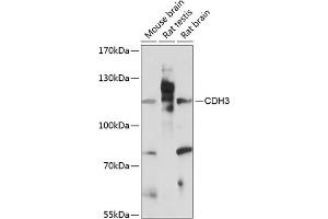 Western blot analysis of extracts of various cell lines, using CDH3 antibody (ABIN7269142) at 1:3000 dilution.